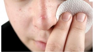 Helpt Paleo tegen acne?